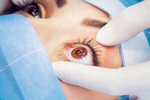 वायु प्रदूषण – मोबाइल र कम्प्युटर चलाउँदा आँखामा निम्तिन्छ थप समस्या